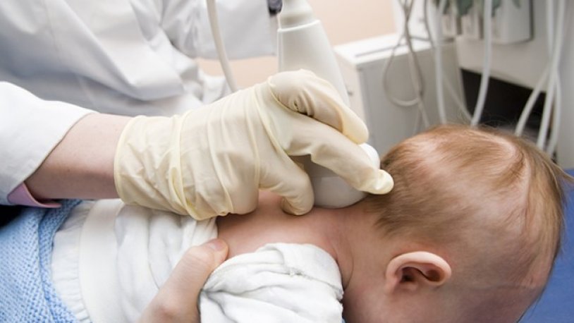 kraniosinostozun nedir bebeginizin kafasinda sekil bozuklugu varsa dikkat gercek gundem