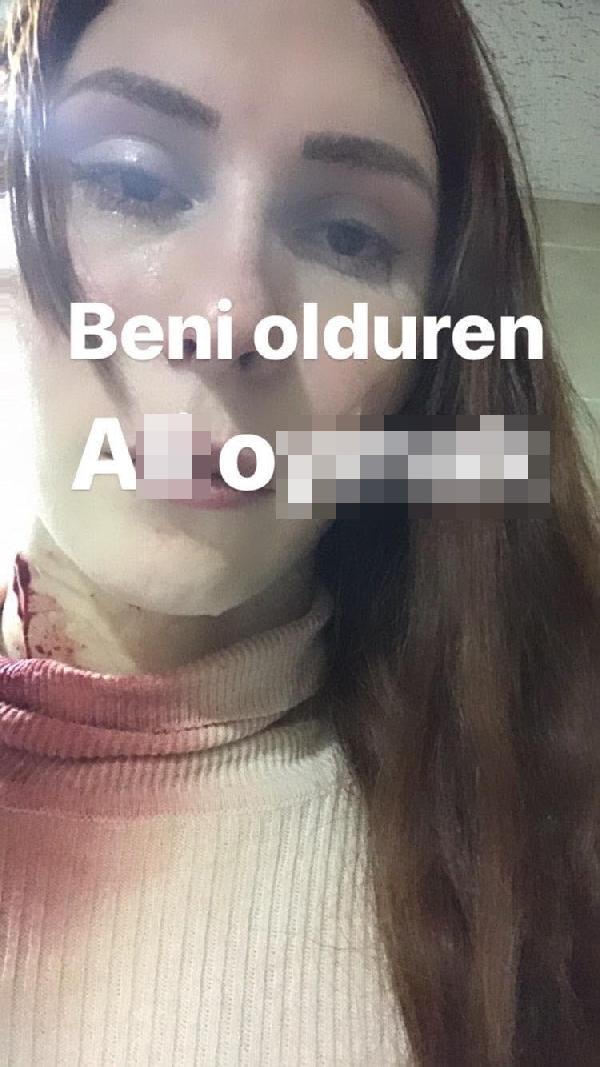 Yayınladığı son fotoğrafla katilinin ismini verdi! - Resim : 1