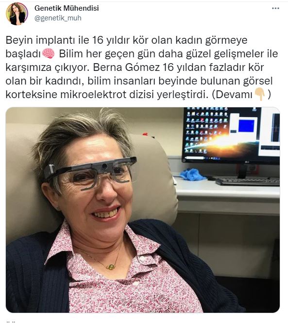 Beyin implantı ile 16 yıldır görmeyen kadın görmeye başladı - Resim : 1